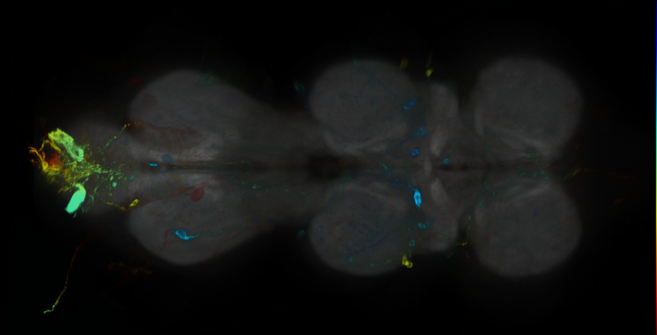 P{GMR25F07-GAL4} expression pattern