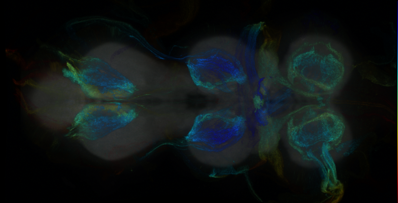 P{GMR25G08-GAL4} expression pattern