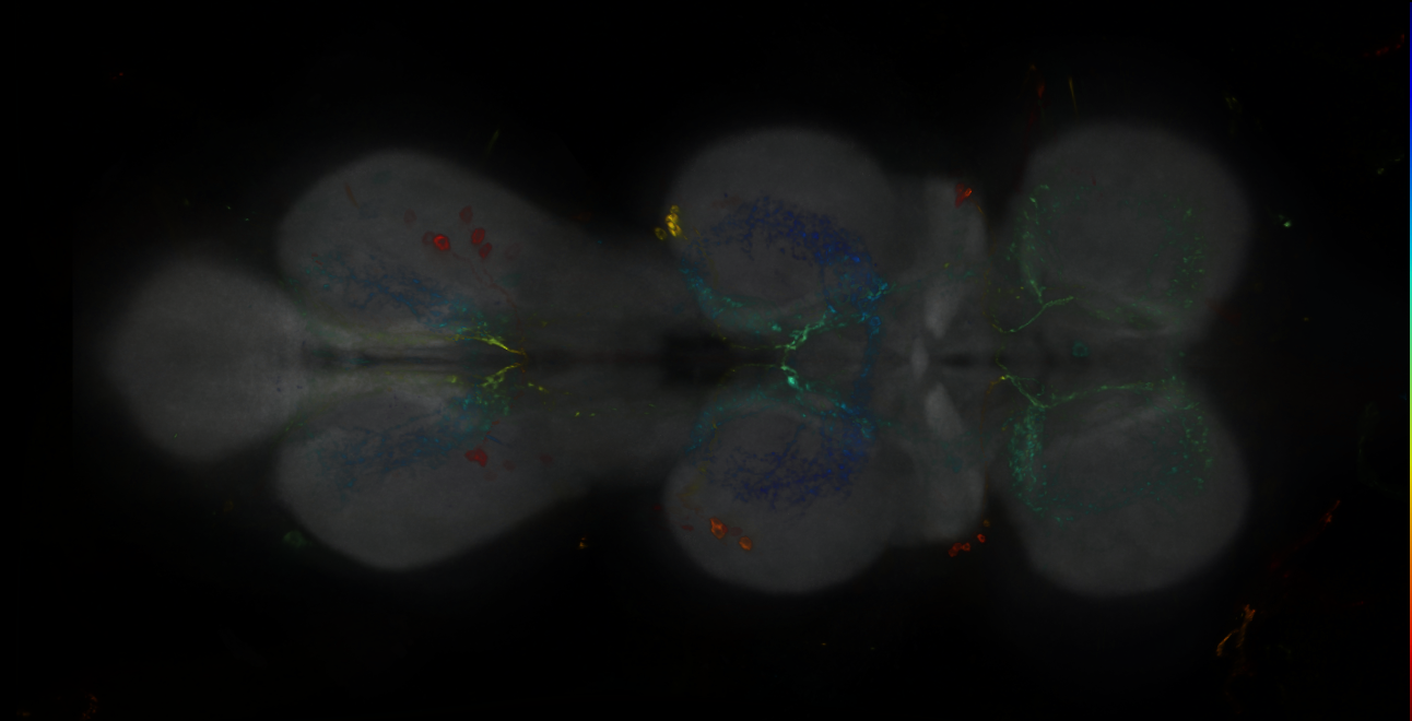 P{GMR25G09-GAL4} expression pattern
