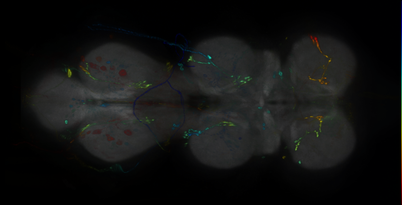 P{GMR25G10-GAL4} expression pattern