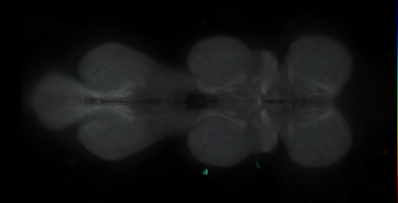 P{GMR25H01-GAL4} expression pattern