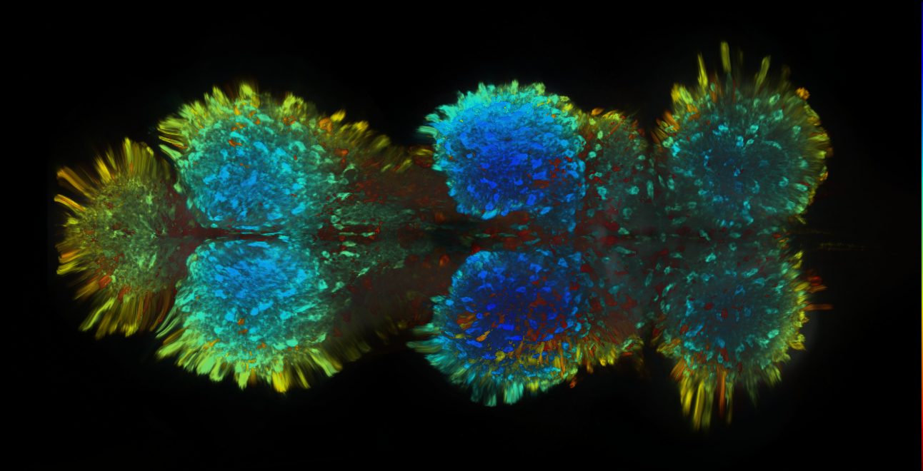 P{GMR25H07-GAL4} expression pattern