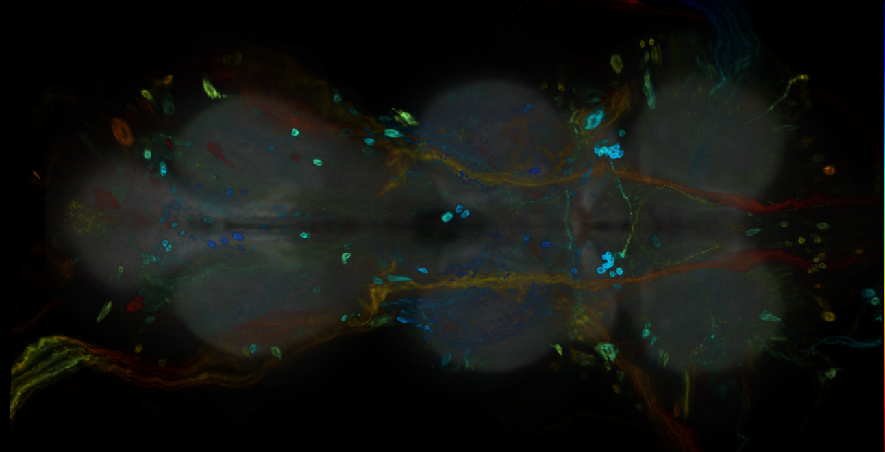 P{GMR27D11-GAL4} expression pattern