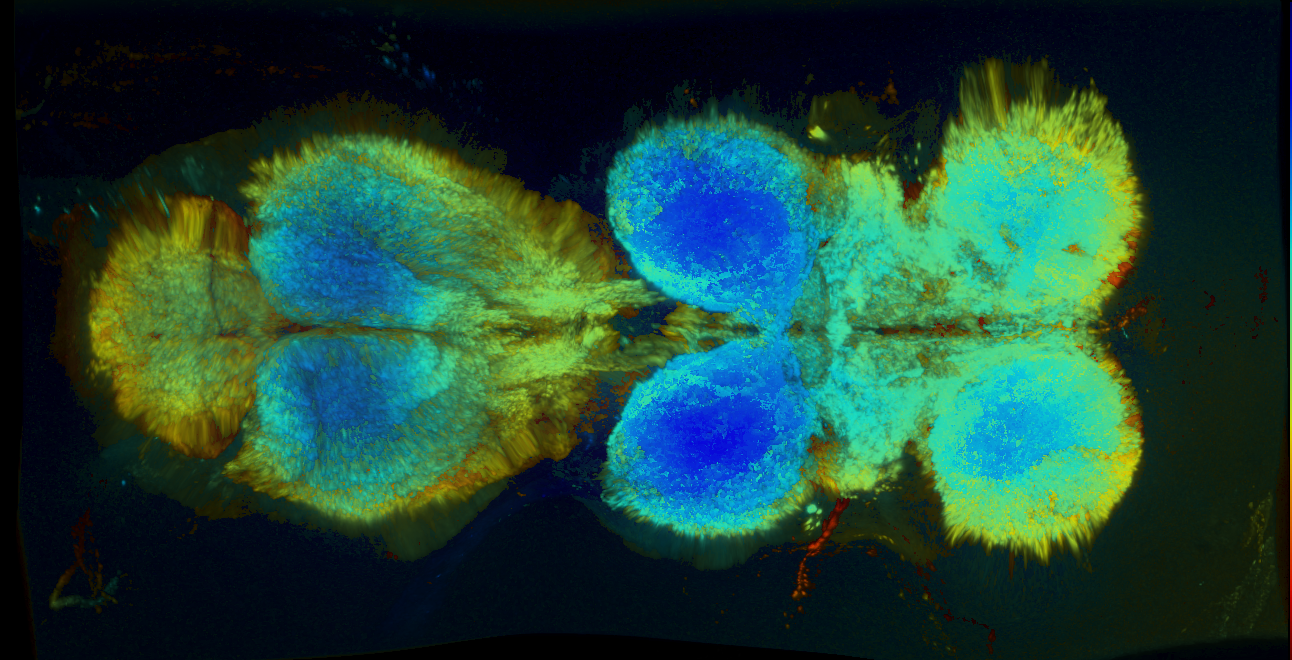 P{GMR27E08-GAL4} expression pattern