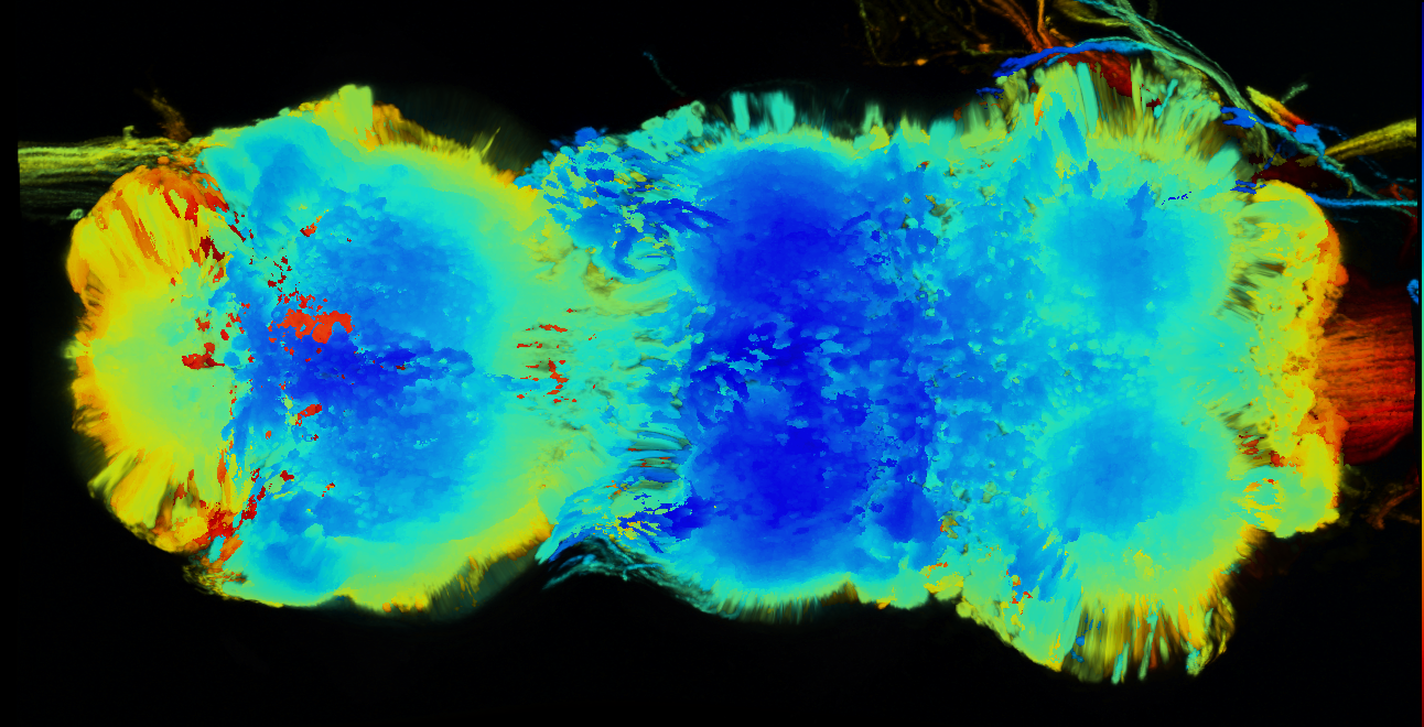 P{GMR27G03-GAL4} expression pattern