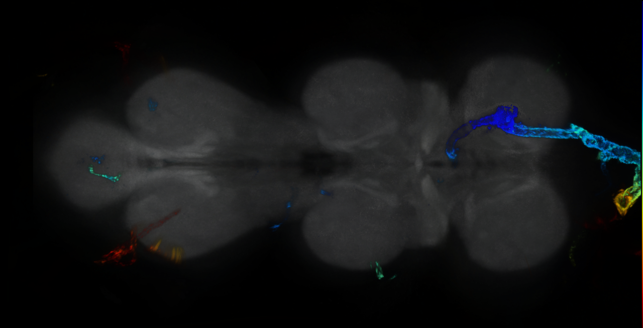 P{GMR28B04-GAL4} expression pattern
