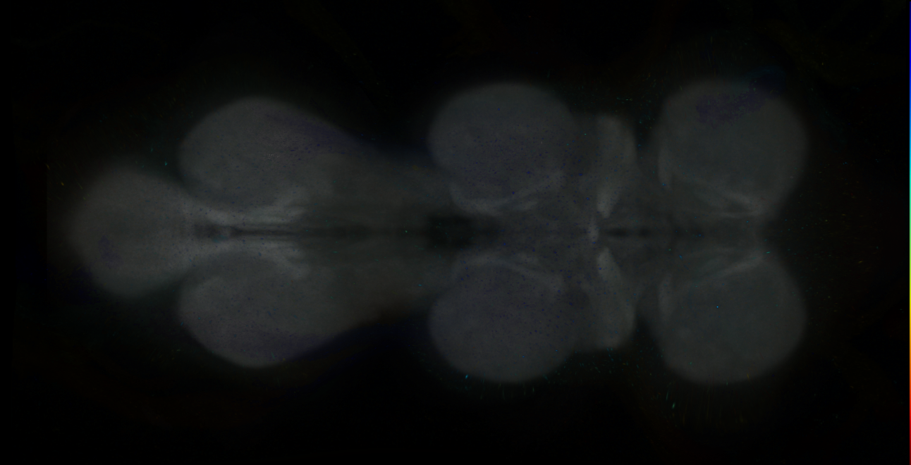 P{GMR29A11-GAL4} expression pattern