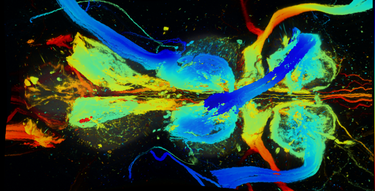P{GMR30B01-GAL4} expression pattern
