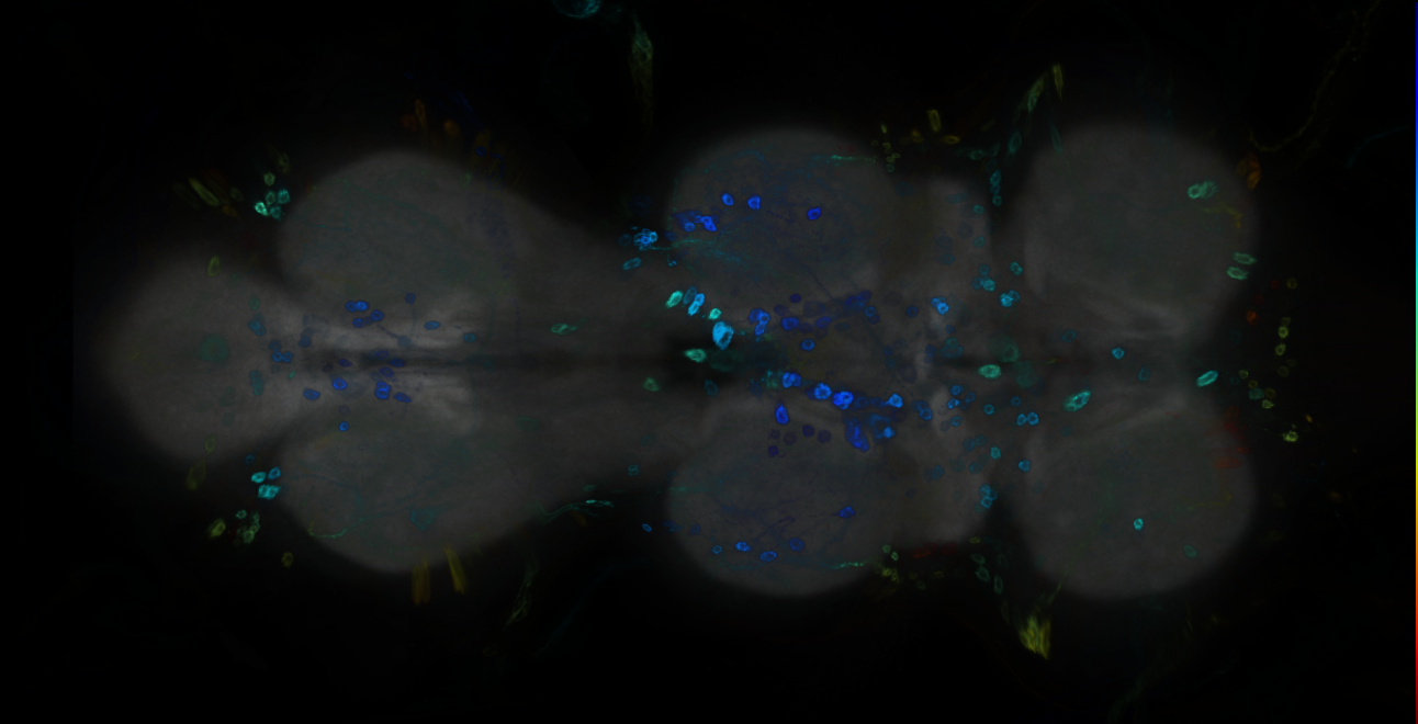 P{GMR30H03-GAL4} expression pattern