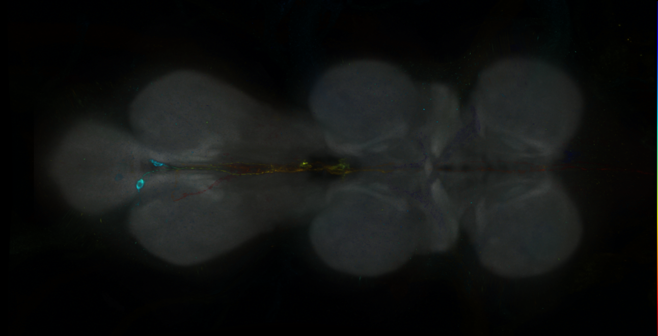 P{GMR30H06-GAL4} expression pattern