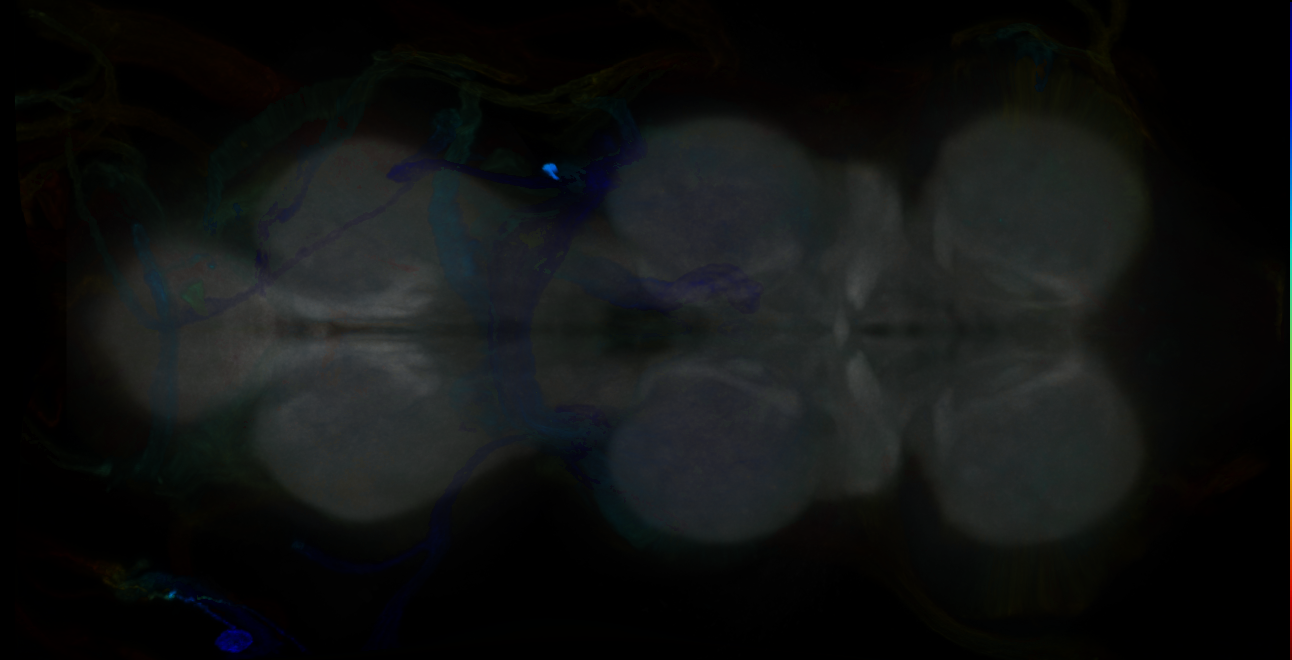 P{GMR31C09-GAL4} expression pattern