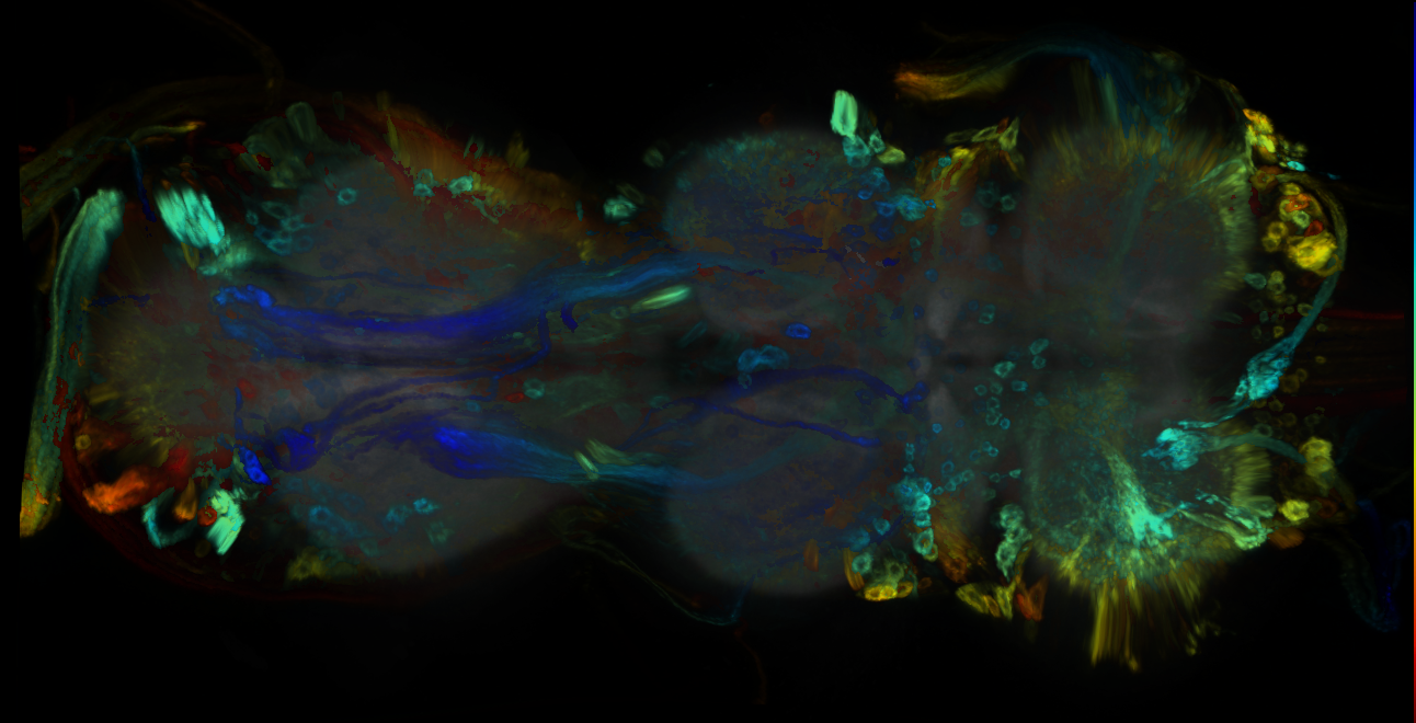 P{GMR31E03-GAL4} expression pattern