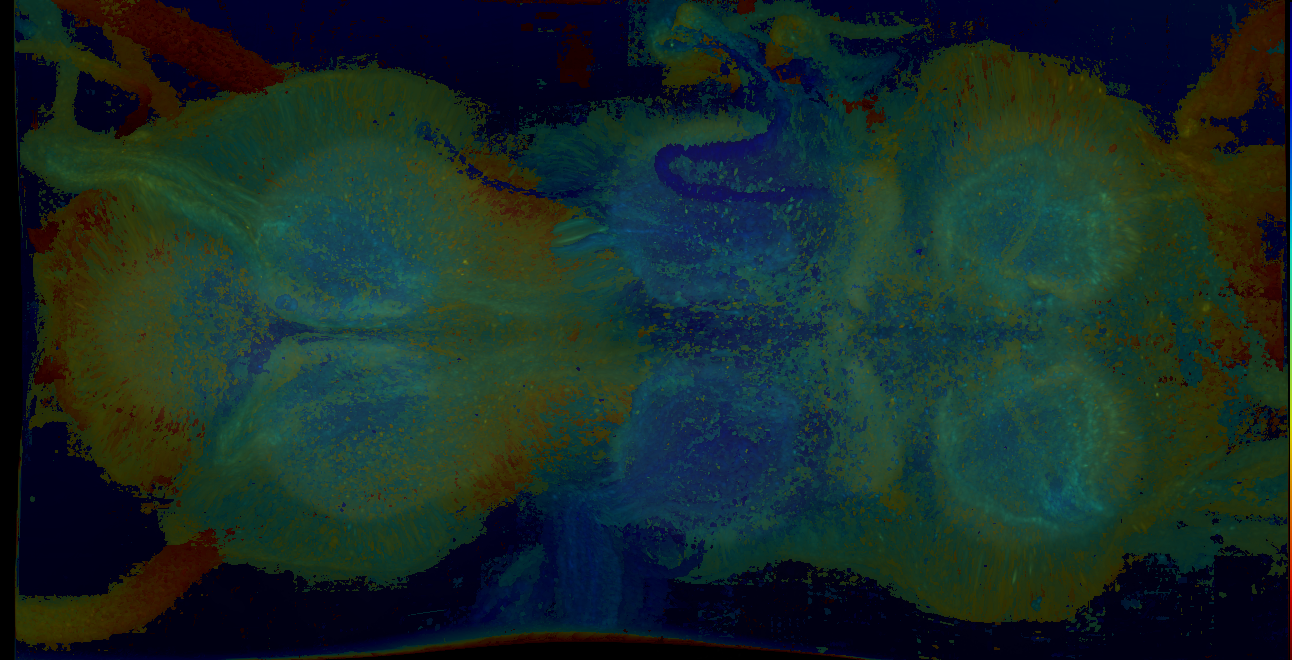 P{GMR31E04-GAL4} expression pattern