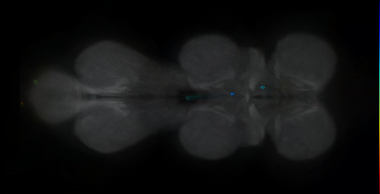 P{GMR31E06-GAL4} expression pattern