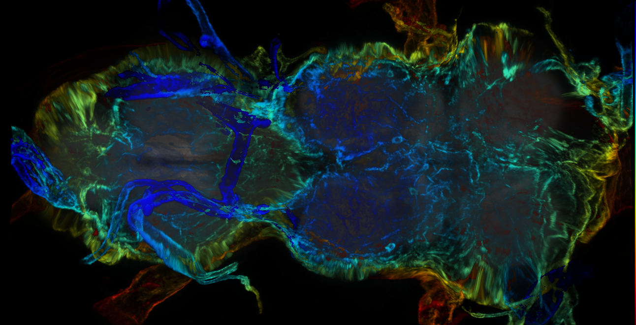 P{GMR31F02-GAL4} expression pattern