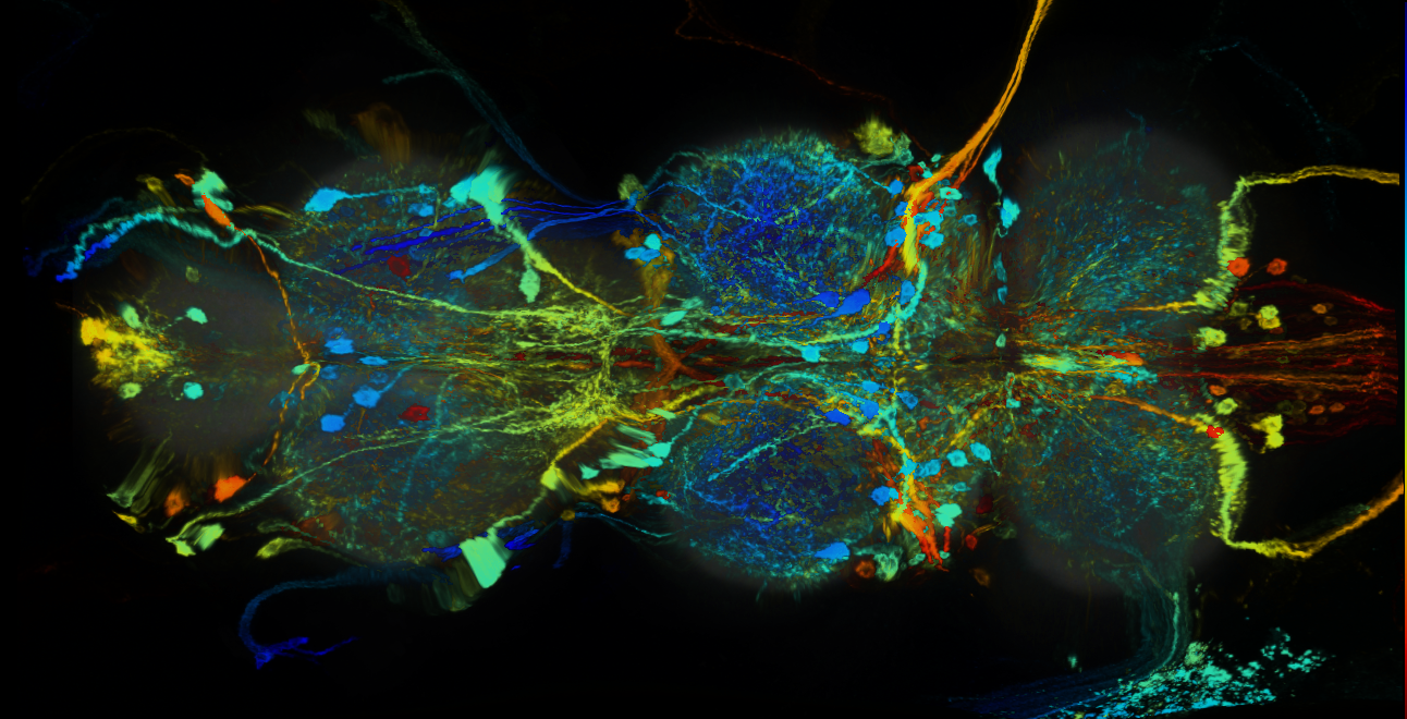 P{GMR31F06-GAL4} expression pattern