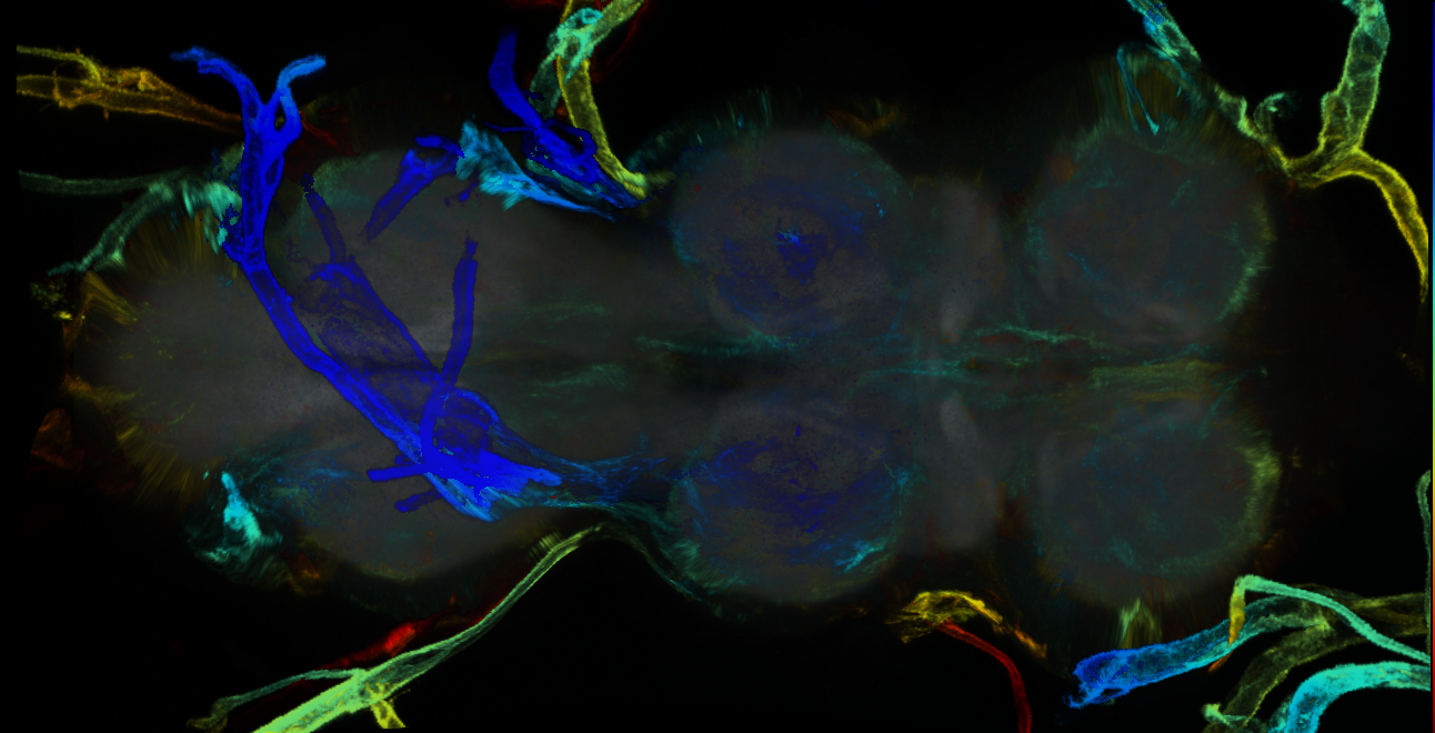 P{GMR31F07-GAL4} expression pattern