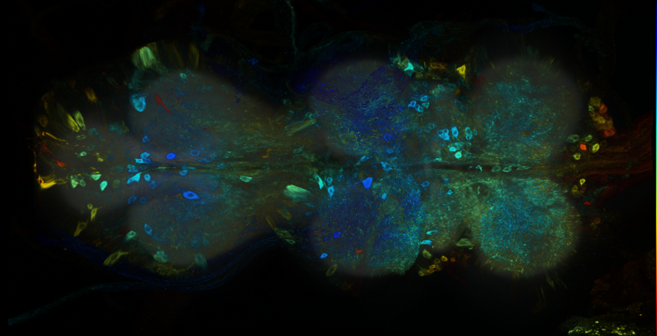 P{GMR31G03-GAL4} expression pattern