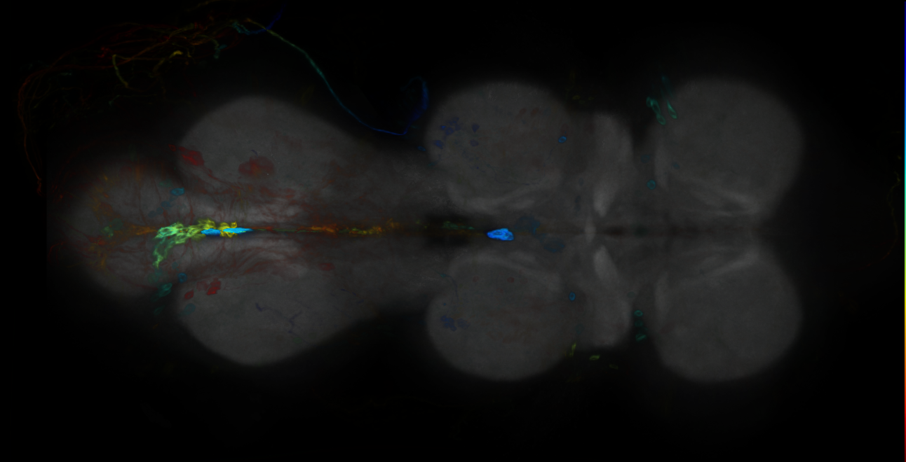 P{GMR31G04-GAL4} expression pattern