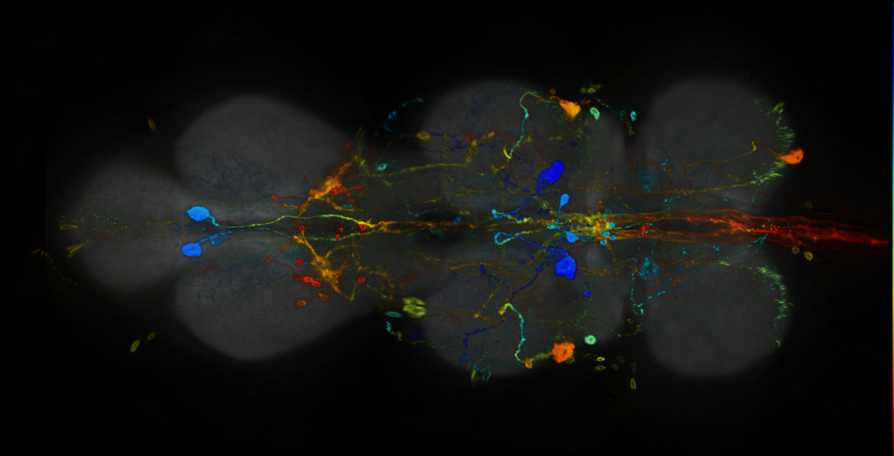 P{GMR31H01-GAL4} expression pattern