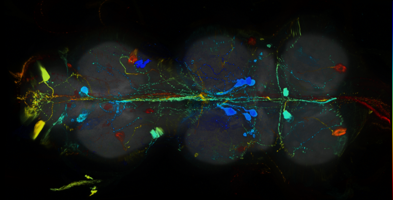 P{GMR32A06-GAL4} expression pattern