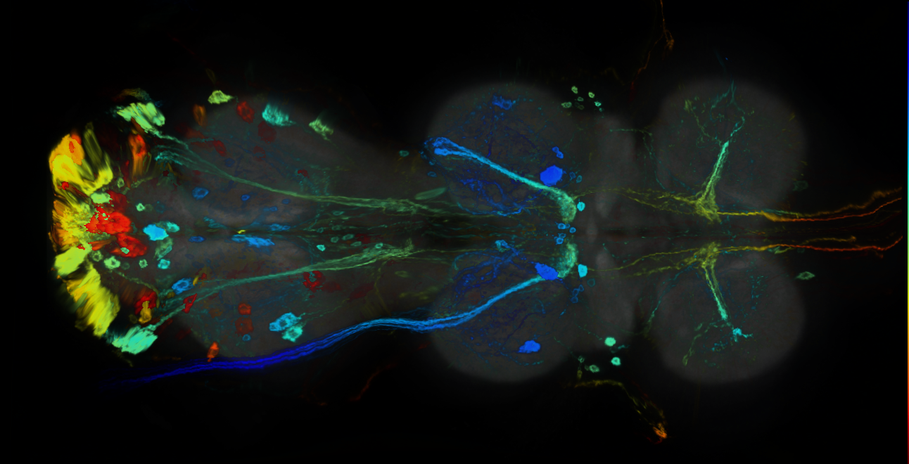 P{GMR32D10-GAL4} expression pattern