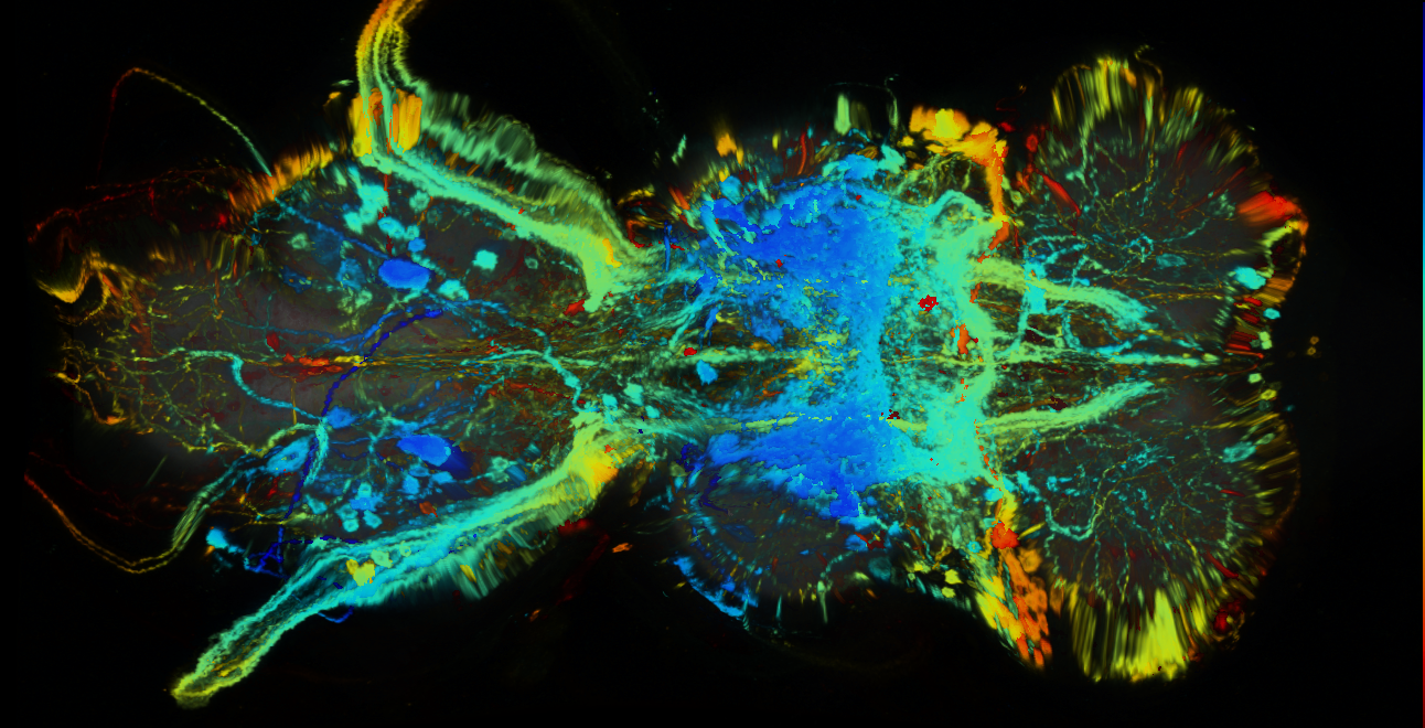P{GMR33B03-GAL4} expression pattern