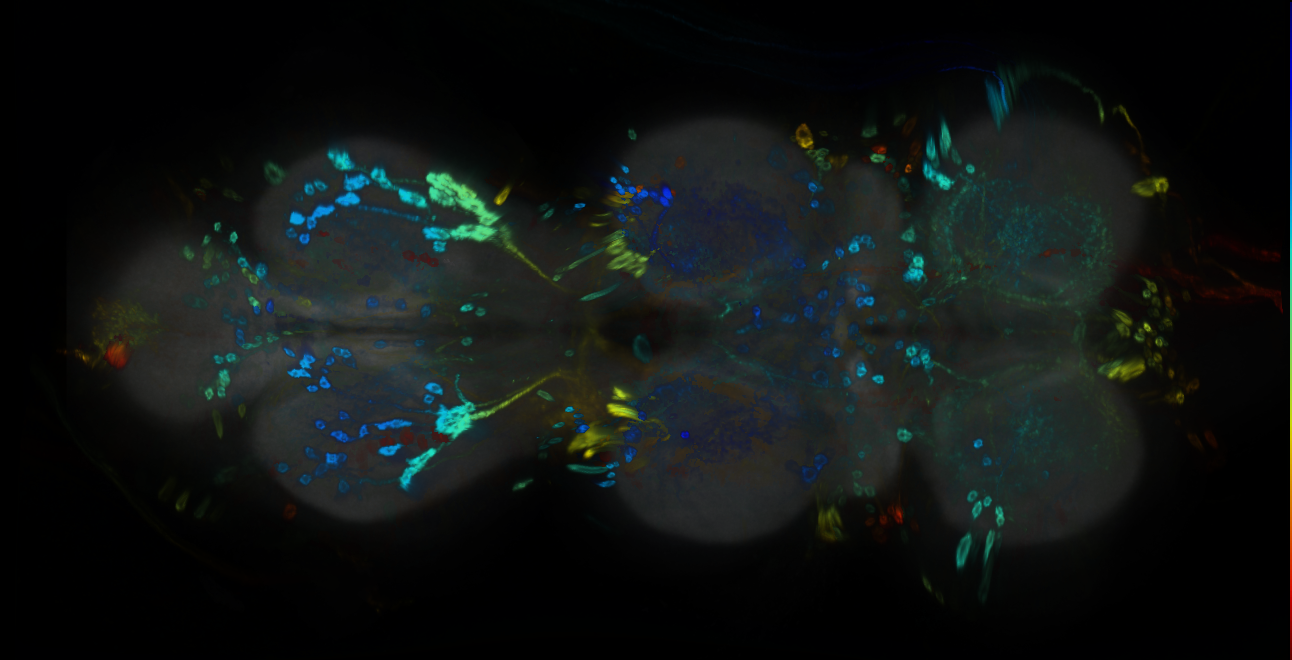 P{GMR33C08-GAL4} expression pattern