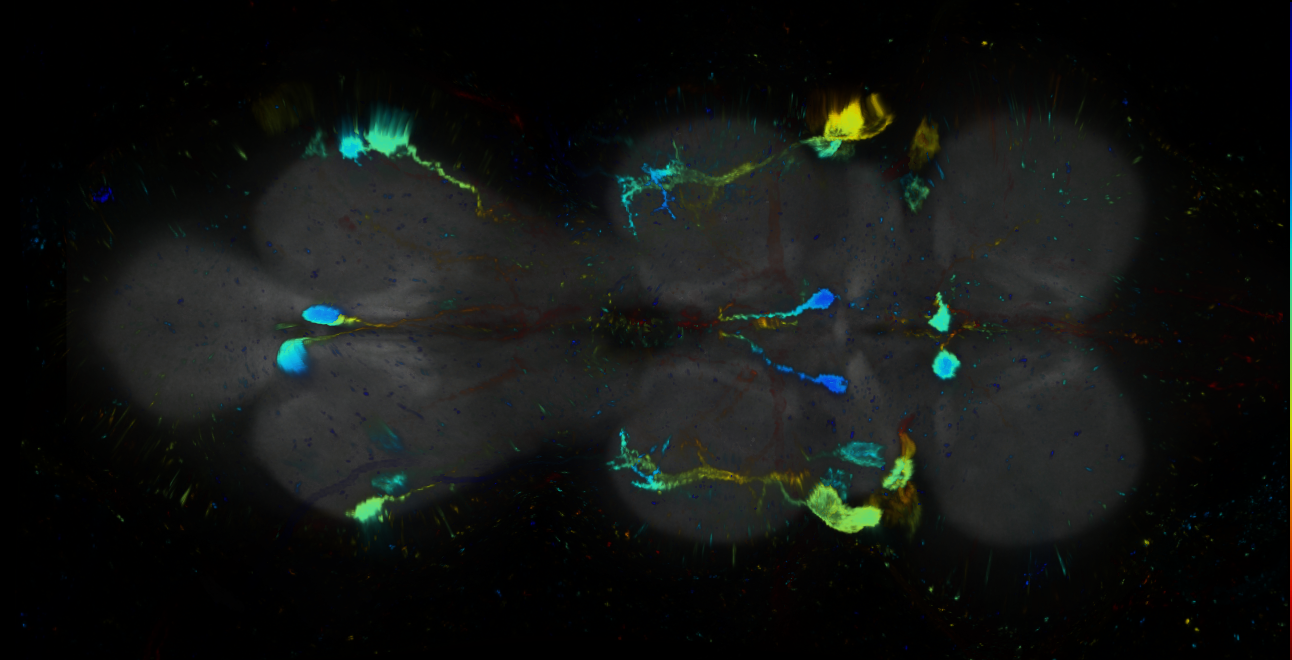 P{GMR33D08-GAL4} expression pattern