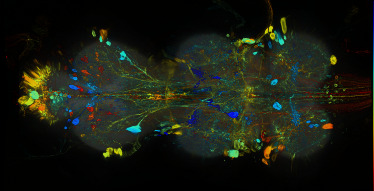 P{GMR33F09-GAL4} expression pattern