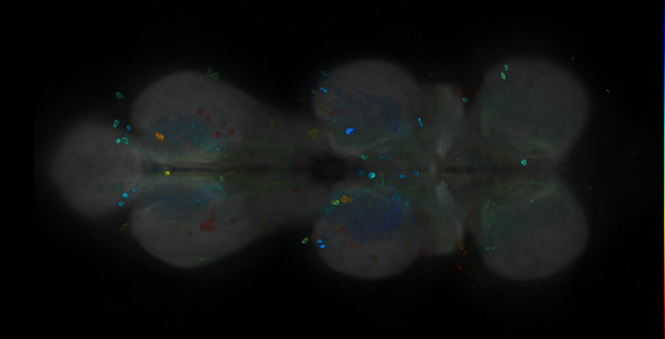 P{GMR33H10-GAL4} expression pattern