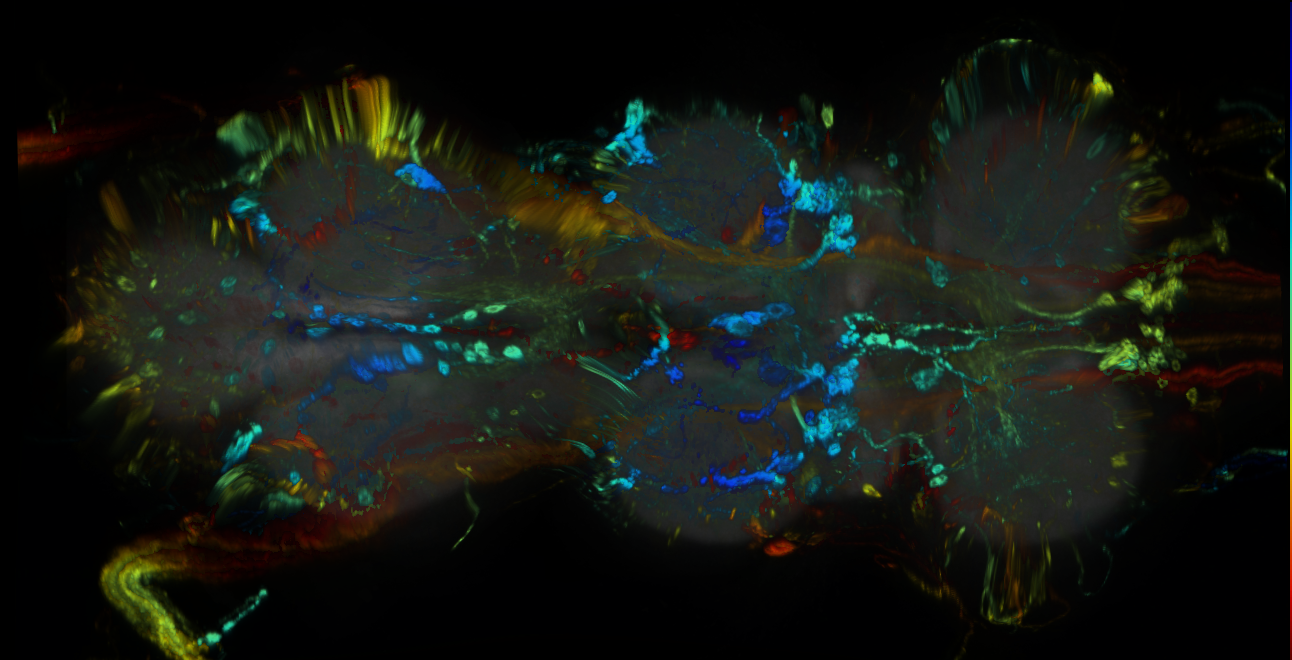 P{GMR34B01-GAL4} expression pattern