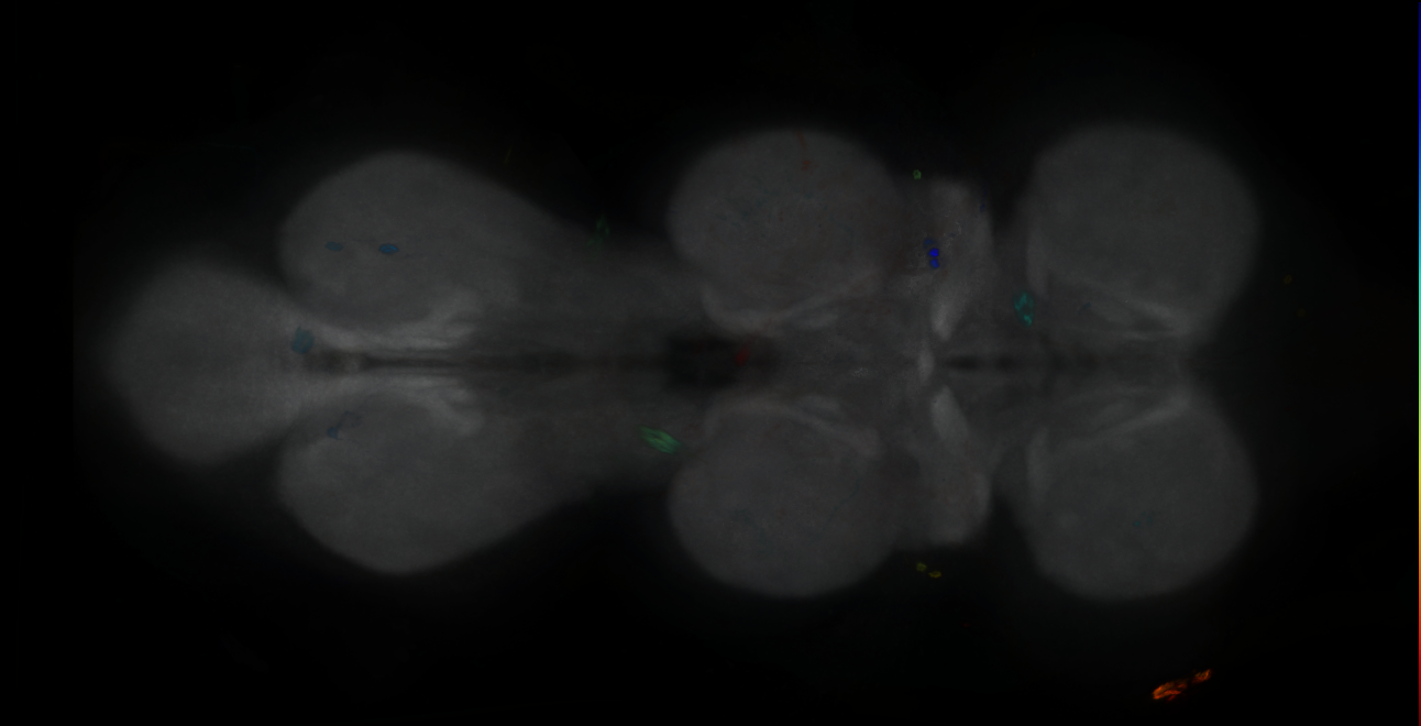 P{GMR34B08-GAL4} expression pattern