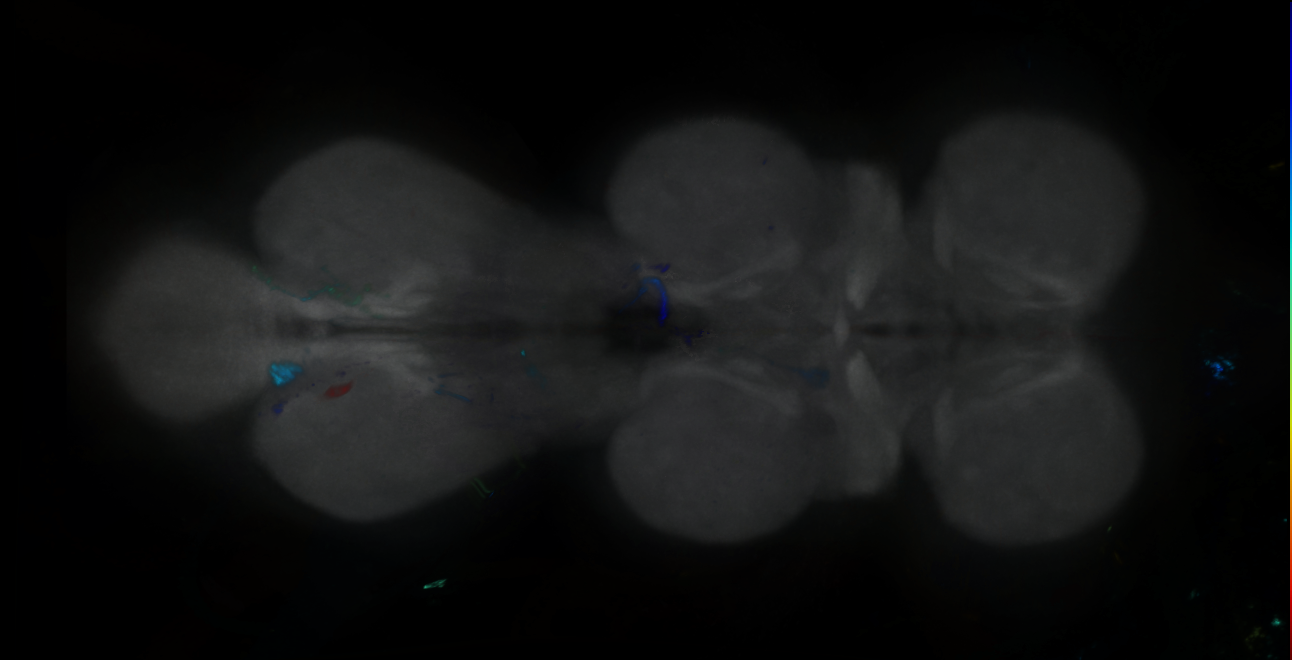 P{GMR34E04-GAL4} expression pattern