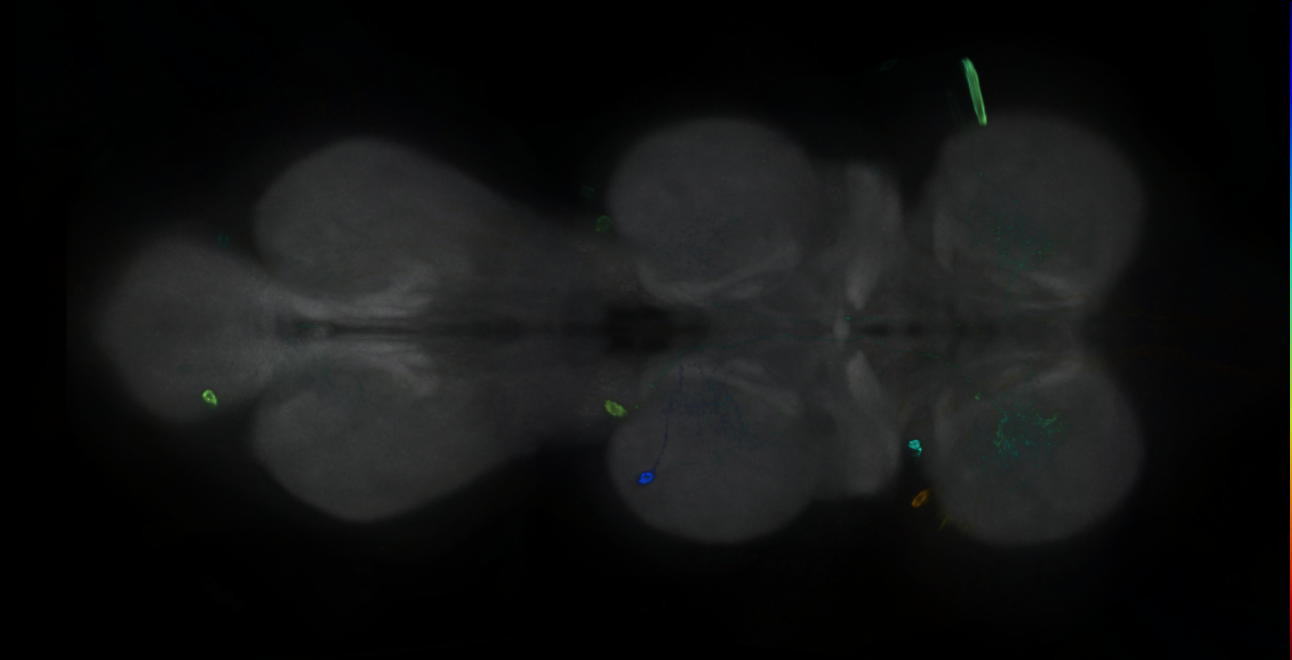 P{GMR34E05-GAL4} expression pattern