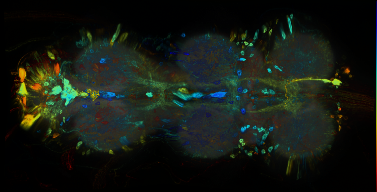 P{GMR34E06-GAL4} expression pattern