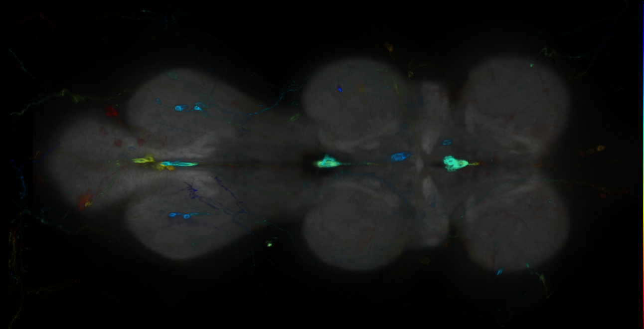 P{GMR34E07-GAL4} expression pattern