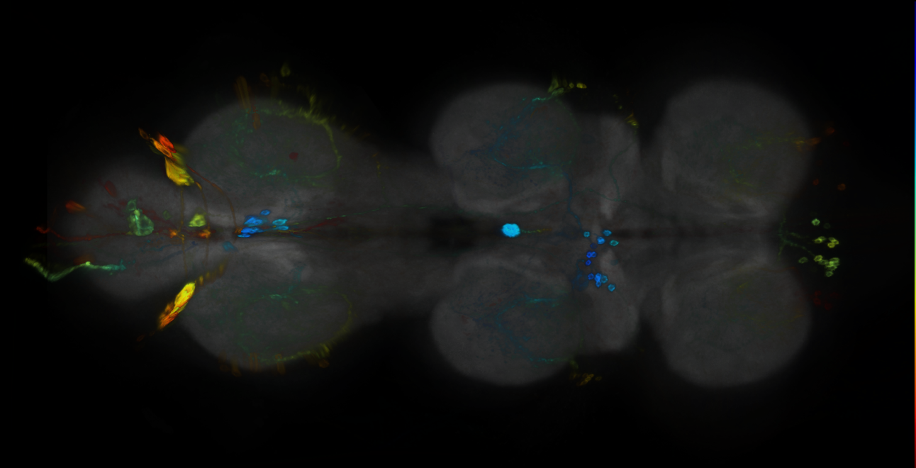 P{GMR34F03-GAL4} expression pattern