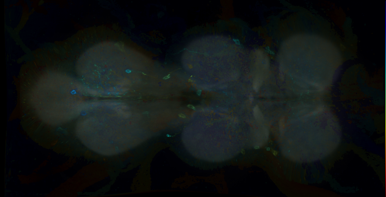 P{GMR34G11-GAL4} expression pattern