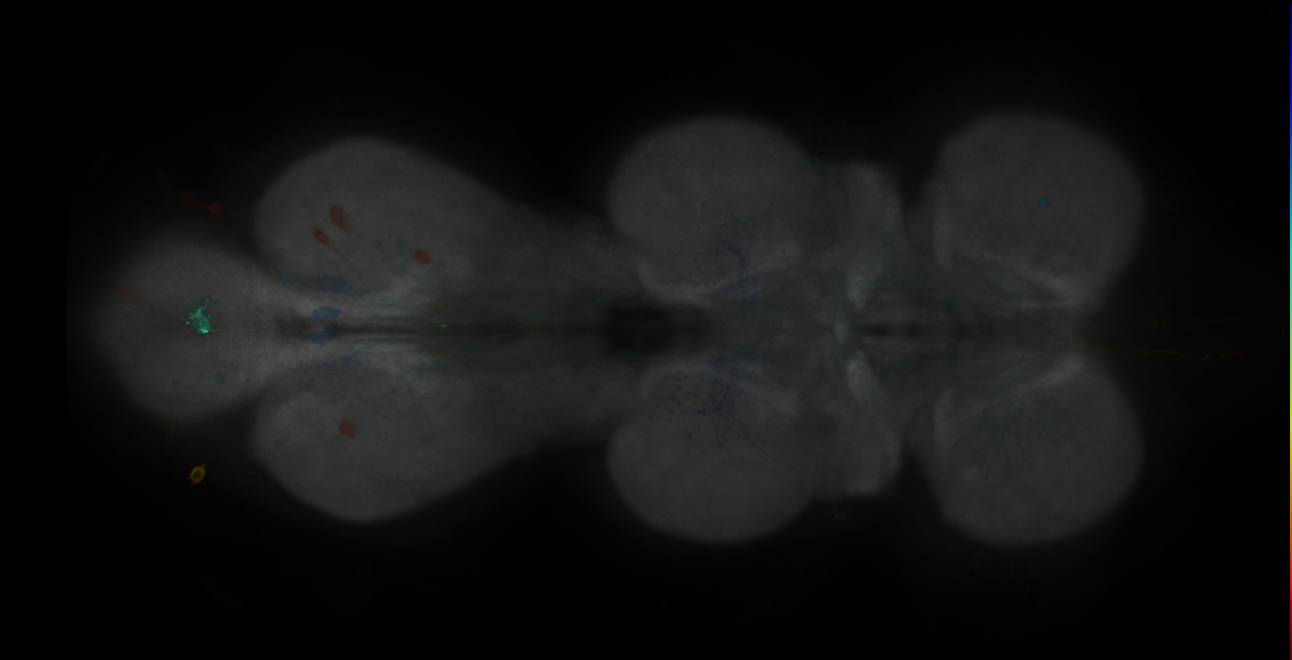 P{GMR35A07-GAL4} expression pattern