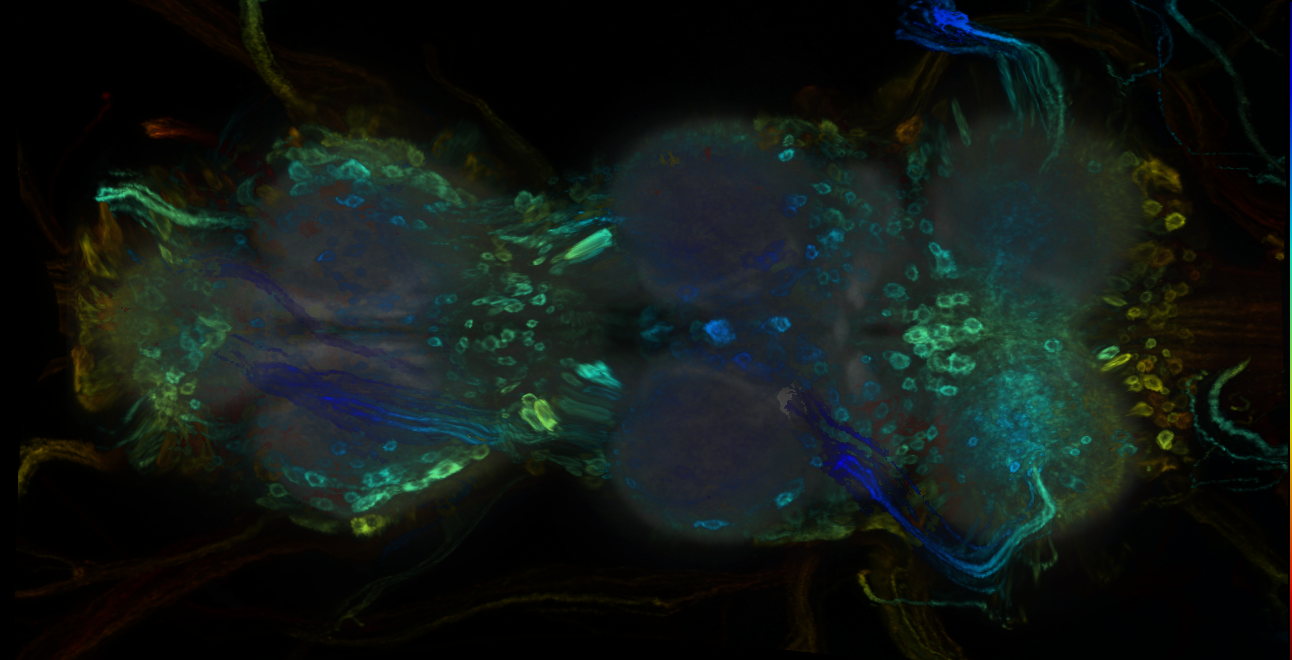 P{GMR35B07-GAL4} expression pattern