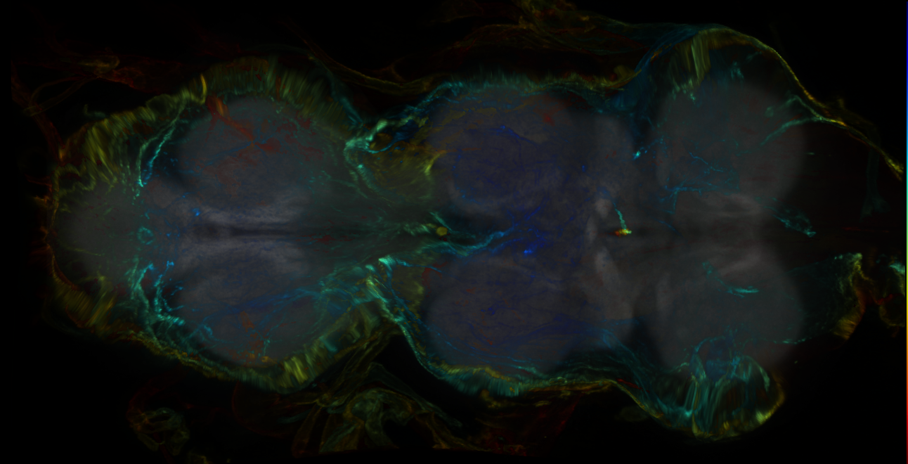 P{GMR35C02-GAL4} expression pattern