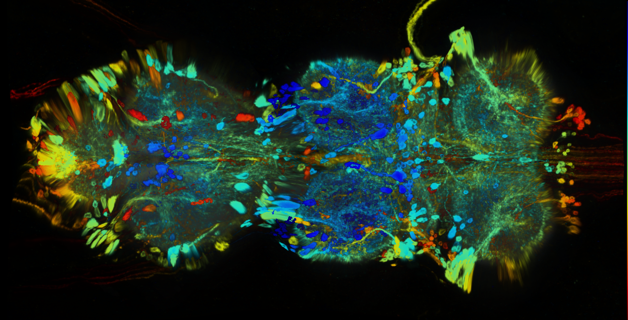 P{GMR35C05-GAL4} expression pattern