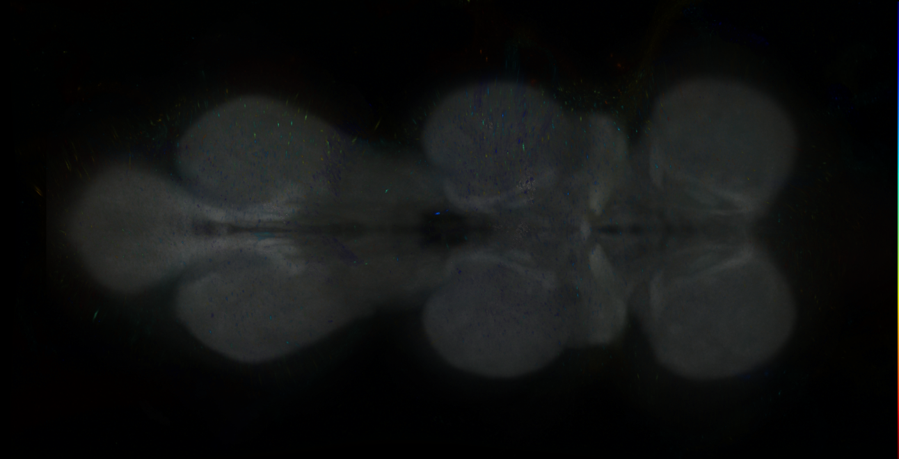 P{GMR36B05-GAL4} expression pattern