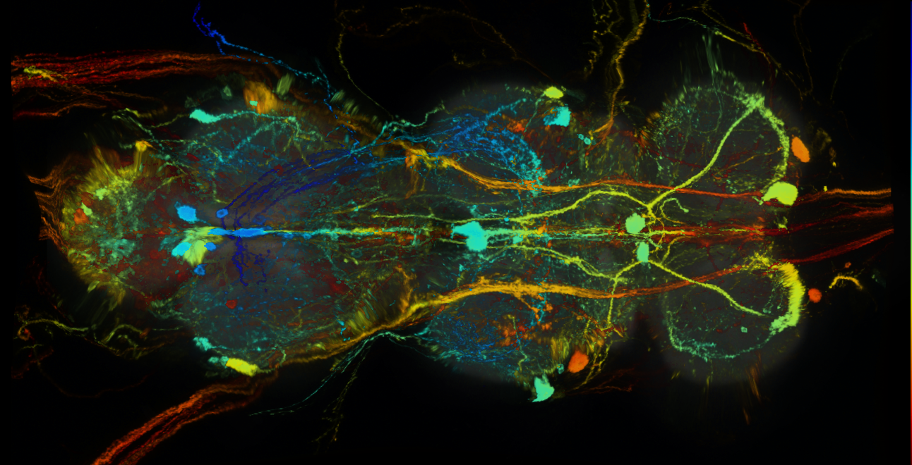 P{GMR36B12-GAL4} expression pattern