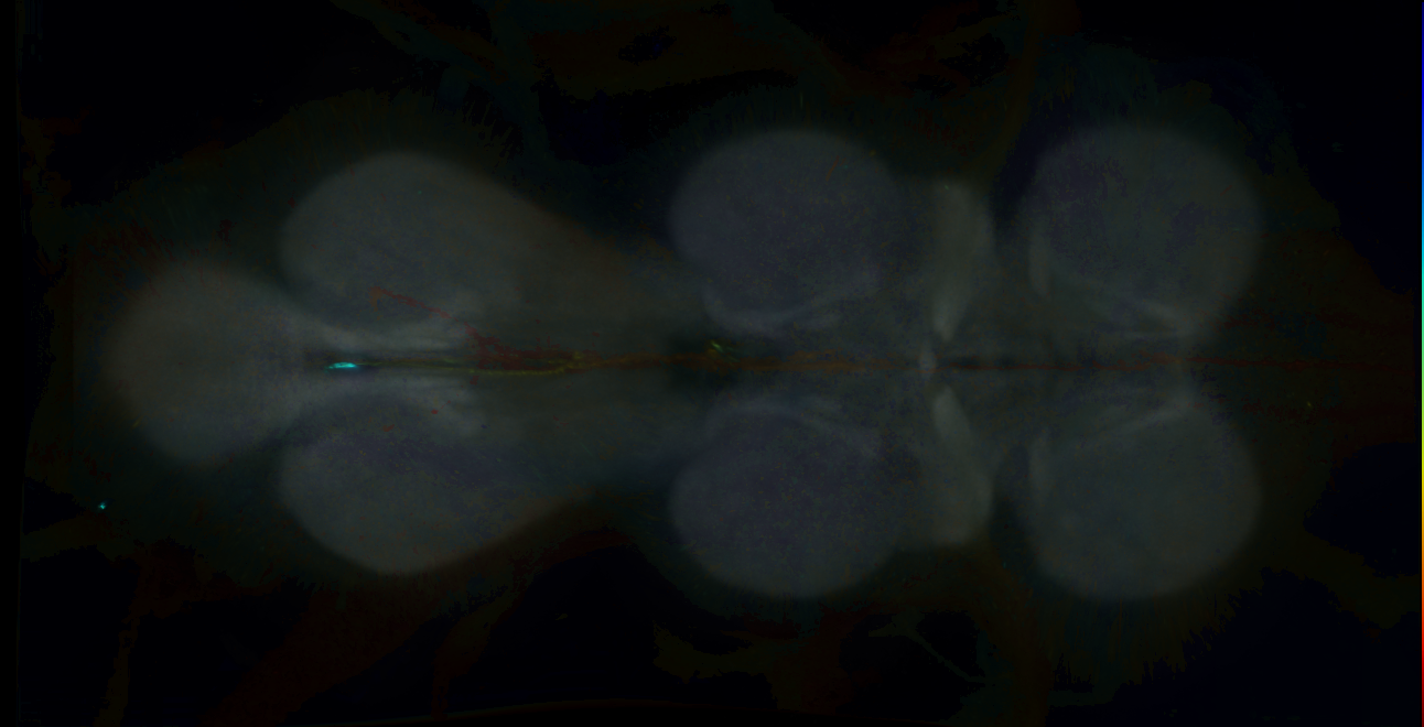 P{GMR36G08-GAL4} expression pattern