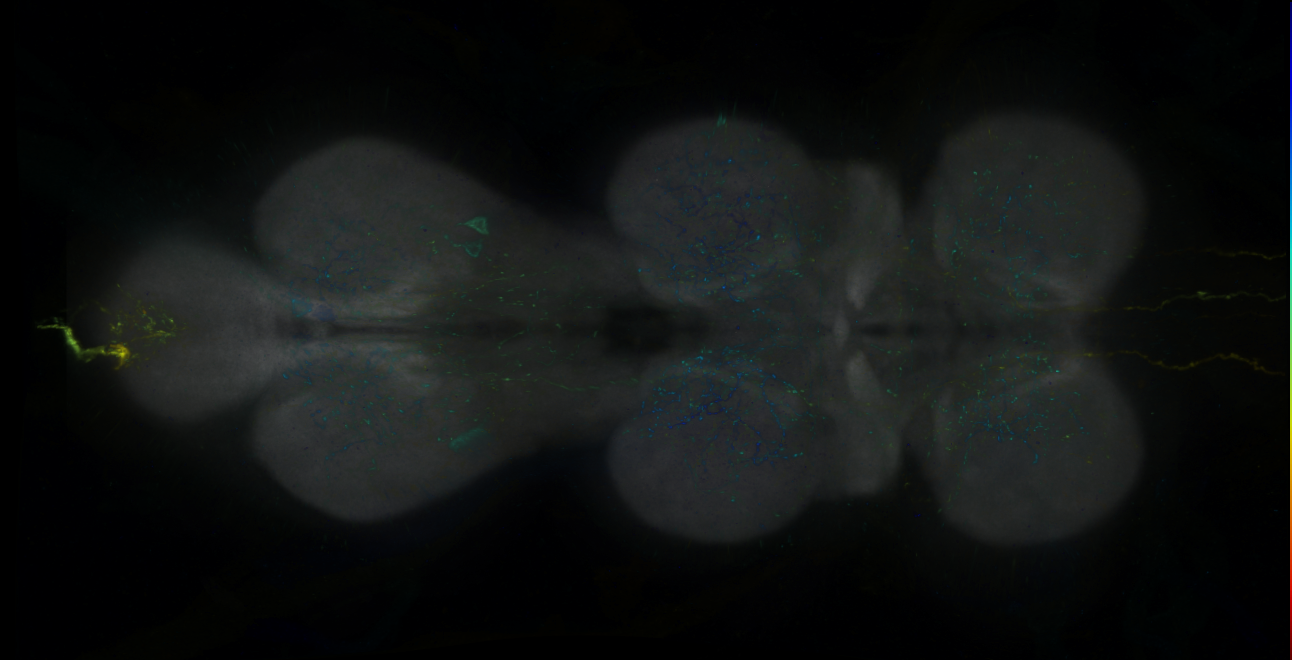 P{GMR38A06-GAL4} expression pattern