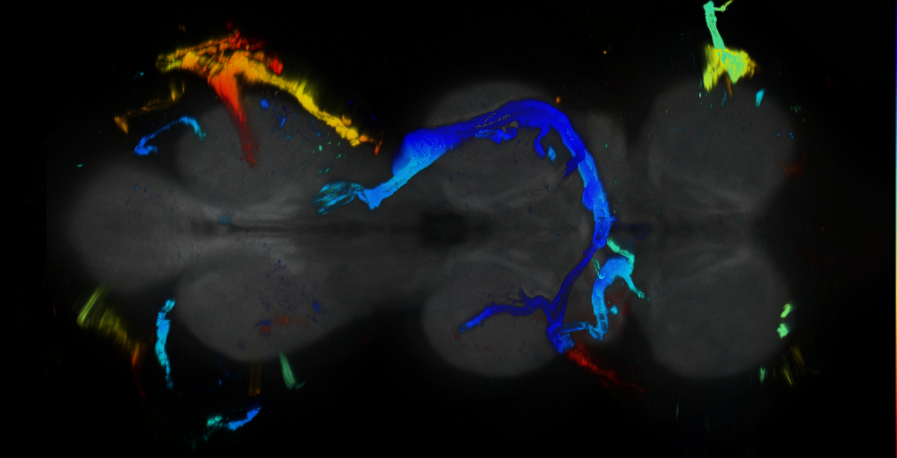 P{GMR38B07-GAL4} expression pattern