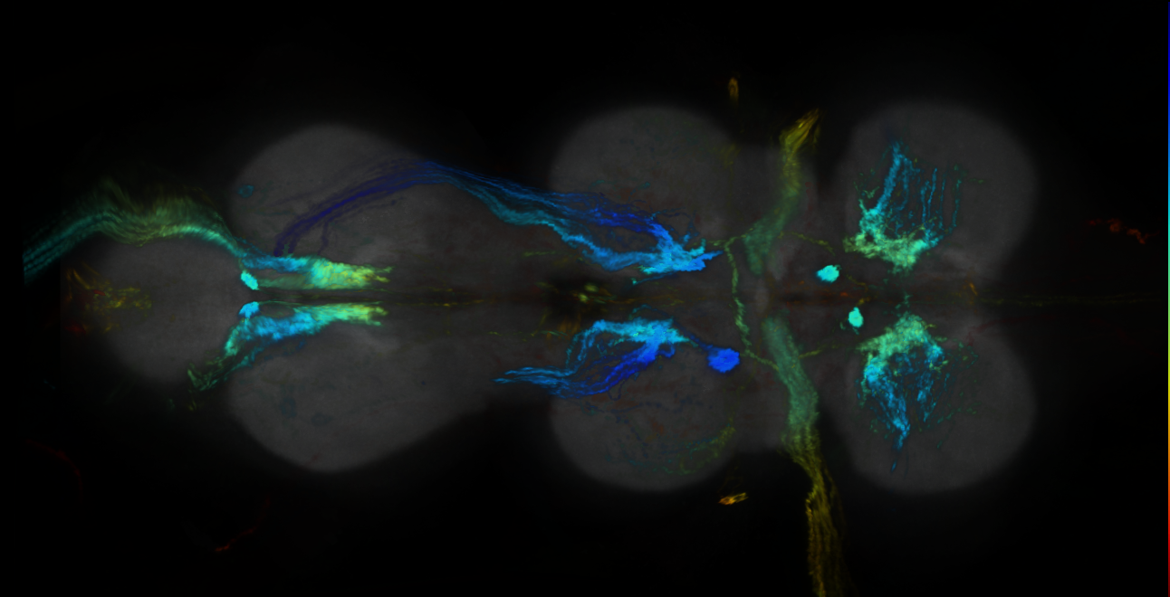 P{GMR38B11-GAL4} expression pattern