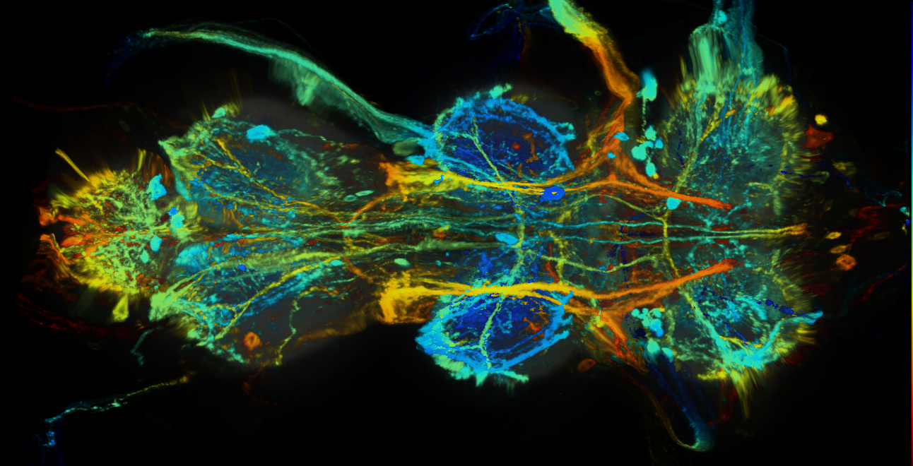P{GMR38C12-GAL4} expression pattern